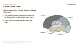Major Depressive Disorder – Neurobiology and Aetiology – slide 7